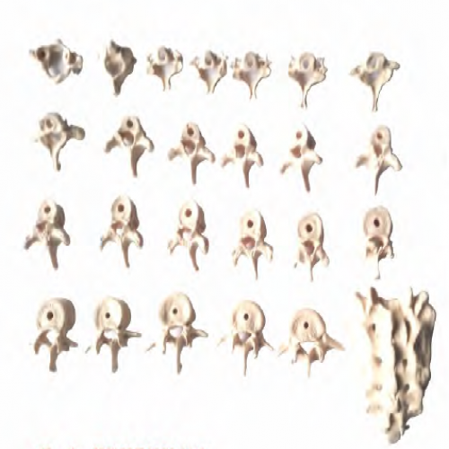 椎骨功能變化示教模型（頸、胸、腰椎骶骨模型）